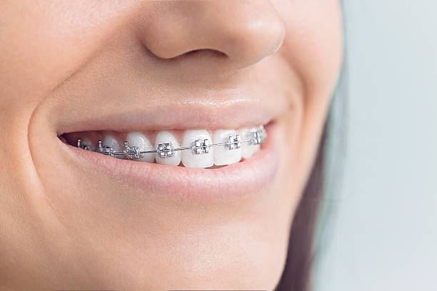 Dental Bonding in Sandstone, MN